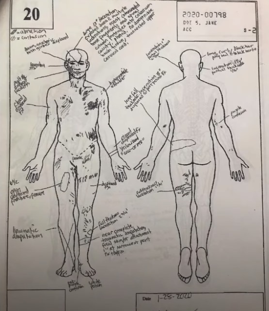 Gigi Autopsy Report Sketch